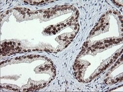 TRMT2A Monoclonal Antibody (OTI1H8), TrueMAB , OriGene 100 &mu;L; Unconjugated:Antibodies,