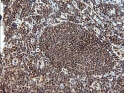 TRMT2A Monoclonal Antibody (OTI1H8), TrueMAB , OriGene 100 &mu;L; Unconjugated:Antibodies,