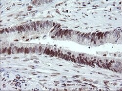 TRMT2A Monoclonal Antibody (OTI1H8), TrueMAB , OriGene 100 &mu;L; Unconjugated:Antibodies,