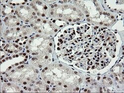 TRMT2A Monoclonal Antibody (OTI1H8), TrueMAB , OriGene 100 &mu;L; Unconjugated:Antibodies,