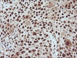 TRMT2A Monoclonal Antibody (OTI3D8), TrueMAB , OriGene 100 &mu;L; Unconjugated:Antibodies,