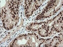 TRMT2A Monoclonal Antibody (OTI3D8), TrueMAB , OriGene 100 &mu;L; Unconjugated:Antibodies,