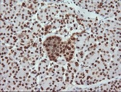 TRMT2A Monoclonal Antibody (OTI3D8), TrueMAB , OriGene 100 &mu;L; Unconjugated:Antibodies,