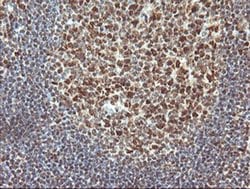 TRMT2A Monoclonal Antibody (OTI3D8), TrueMAB , OriGene 100 &mu;L; Unconjugated:Antibodies,