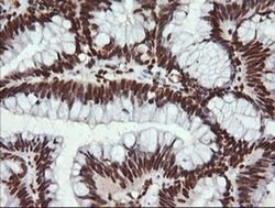 TRMT2A Monoclonal Antibody (OTI3D8), TrueMAB , OriGene 100 &mu;L; Unconjugated:Antibodies,