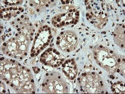 TRMT2A Monoclonal Antibody (OTI3D8), TrueMAB , OriGene 100 &mu;L; Unconjugated:Antibodies,