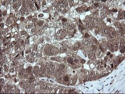 TRMT2A Mouse anti-Human, Clone: OTI3B3, lyophilized, TrueMAB 100 &mu;g;