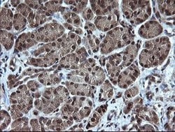 TRMT2A Mouse anti-Human, Clone: OTI3B3, lyophilized, TrueMAB 100 &mu;g;
