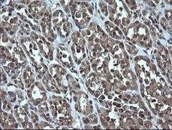 TRMT2A Mouse anti-Human, Clone: OTI3B3, lyophilized, TrueMAB 100 &mu;g;