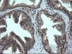 TRMT2A Mouse anti-Human, Clone: OTI3B3, lyophilized, TrueMAB 100 &mu;g;