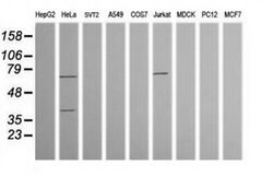 TRMT2A Monoclonal Antibody (OTI2C6), TrueMAB , OriGene 30 &mu;L; Unconjugated:Antibodies,