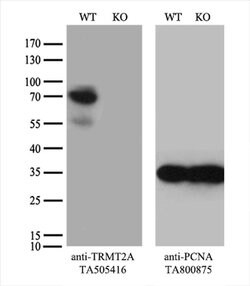 TRMT2A Monoclonal Antibody (OTI2A1), TrueMAB , OriGene 100 &mu;L; Unconjugated:Antibodies,