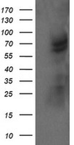 TRMT2A Monoclonal Antibody (OTI1H8), TrueMAB , OriGene 100 &mu;L; Unconjugated:Antibodies,