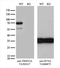 TRMT2A Monoclonal Antibody (OTI1H8), TrueMAB , OriGene 100 &mu;L; Unconjugated:Antibodies,