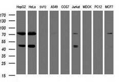 TRMT2A Mouse anti-Human, Clone: OTI1G8, liquid, TrueMAB 100 &mu;L; Unconjugated:Antibodies,