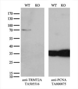 TRMT2A Mouse anti-Human, Clone: OTI1G8, liquid, TrueMAB 100 &mu;L; Unconjugated:Antibodies,