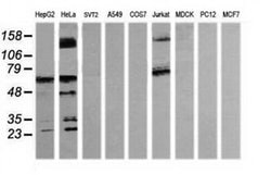 TRMT2A Monoclonal Antibody (OTI3D8), TrueMAB , OriGene 100 &mu;L; Unconjugated:Antibodies,