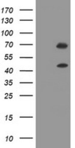 TRMT2A Mouse anti-Human, Clone: OTI3B7, lyophilized, TrueMAB 100 &mu;g;