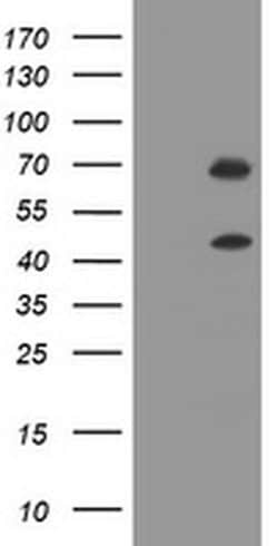 TRMT2A Monoclonal Antibody (OTI3B7), TrueMAB , OriGene:Antibodies:Primary