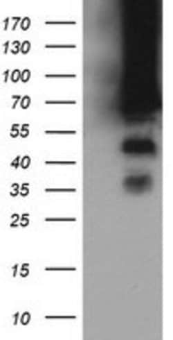 TRMT2A Mouse anti-Human, Clone: OTI3B3, lyophilized, TrueMAB 100 &mu;g;