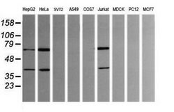 TRMT2A Mouse anti-Human, Clone: OTI3B3, lyophilized, TrueMAB 100 &mu;g;