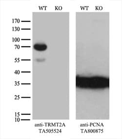 TRMT2A Mouse anti-Human, Clone: OTI3B3, lyophilized, TrueMAB 100 &mu;g;
