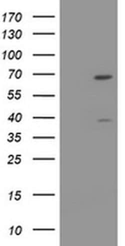 TRMT2A Monoclonal Antibody (OTI3A4), TrueMAB , OriGene:Antibodies:Primary