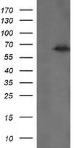 TRMT2A Mouse anti-Human, Clone: OTI1H2, lyophilized, TrueMAB 100 &mu;g;