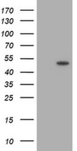 TRMU Monoclonal Antibody (OTI2B6), TrueMAB , OriGene 100 &mu;L; Unconjugated:Antibodies,