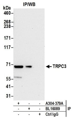 TRPC3 Rabbit anti-Human, Polyclonal, Bethyl Laboratories 100 &mu;L; Unconjugated:Antibodies,
