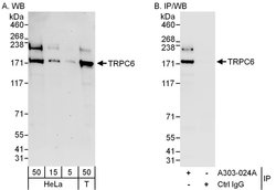 TRPC6 Rabbit anti-Human, Polyclonal, Bethyl Laboratories 100 &mu;L; Unconjugated:Antibodies,