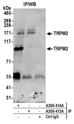 TRPM2 Rabbit anti-Human, Polyclonal, Bethyl Laboratories 100 &mu;L; Unconjugated:Antibodies,