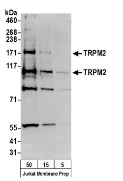 TRPM2 Rabbit anti-Human, Polyclonal, Bethyl Laboratories 100 &mu;L; Unconjugated:Antibodies,