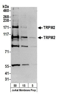 TRPM2 Polyclonal Antibody, Bethyl Laboratories 20 &mu;L; Unconjugated:Antibodies,