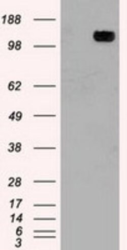 TRPM4 Mouse anti-Human, Clone: OTI3C4, lyophilized, TrueMAB 100 &mu;g;