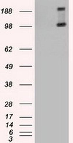 TRPM4 Mouse anti-Human, Clone: OTI14F1, liquid, TrueMAB 100 &mu;L | Buy Online | Origene Technologies | Fisher Scientific
