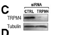 TRPM4 Mouse anti-Canine, Human, Clone: OTI10H5, liquid, TrueMAB 30 &mu;L;