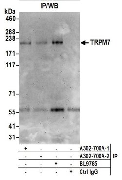 TRPM7 Rabbit anti-Human, Polyclonal, Bethyl Laboratories 100 &mu;L; Unconjugated:Antibodies,