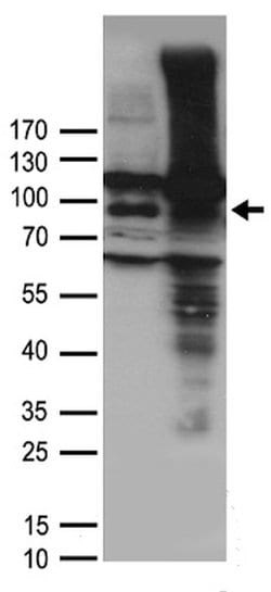 TRPV1 Polyclonal Antibody, OriGene 100 &mu;L; Unconjugated:Antibodies,