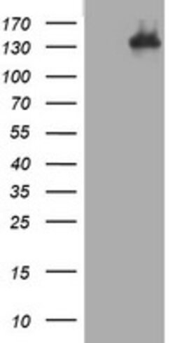 TSC1 Mouse anti-Human, Clone: OTI2G3, lyophilized, TrueMAB 100 &mu;g; Unconjugated:Antibodies,