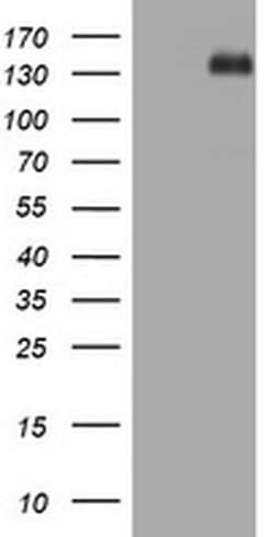 TSC1 Monoclonal Antibody (OTI5A7), TrueMAB , OriGene:Antibodies:Primary