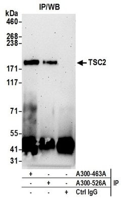 TSC2 Rabbit anti-Human, Polyclonal, Bethyl Laboratories 10 &mu;L; Unconjugated:Antibodies,