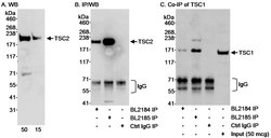 TSC2 Rabbit anti-Human, Polyclonal, Bethyl Laboratories 100 &mu;L; Unconjugated:Antibodies,