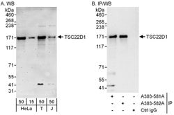 TSC22D1 Rabbit anti-Human, Polyclonal, Bethyl Laboratories 100 &mu;L; Unconjugated:Antibodies,