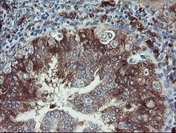 TSC22D1 Monoclonal Antibody (OTI1A5), TrueMAB , OriGene 100 &mu;L; Unconjugated:Antibodies,