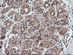 TSC22D1 Monoclonal Antibody (OTI3B10), TrueMAB , OriGene 30 &mu;L; Unconjugated:Antibodies,