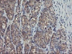 TSC22D1 Monoclonal Antibody (OTI4F1), TrueMAB , OriGene 30 &mu;L; Unconjugated:Antibodies,