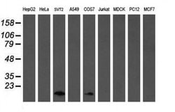 TSC22D1 Monoclonal Antibody (OTI1A5), TrueMAB , OriGene 100 &mu;L; Unconjugated:Antibodies,