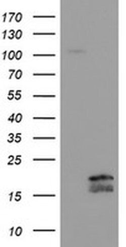 TSC22D1 Monoclonal Antibody (OTI3B10), TrueMAB , OriGene 30 &mu;L; Unconjugated:Antibodies,