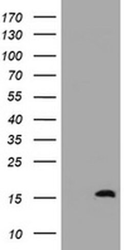 TSC22D1 Monoclonal Antibody (OTI2G3), TrueMAB , OriGene 100 &mu;L; Unconjugated:Antibodies,